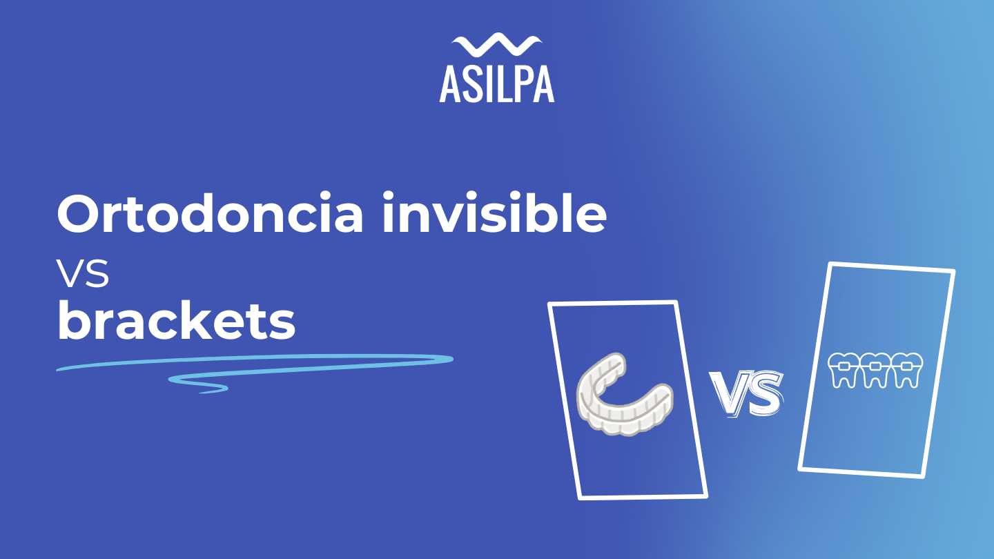 Que es mejor ortodoncia invisible o brackets