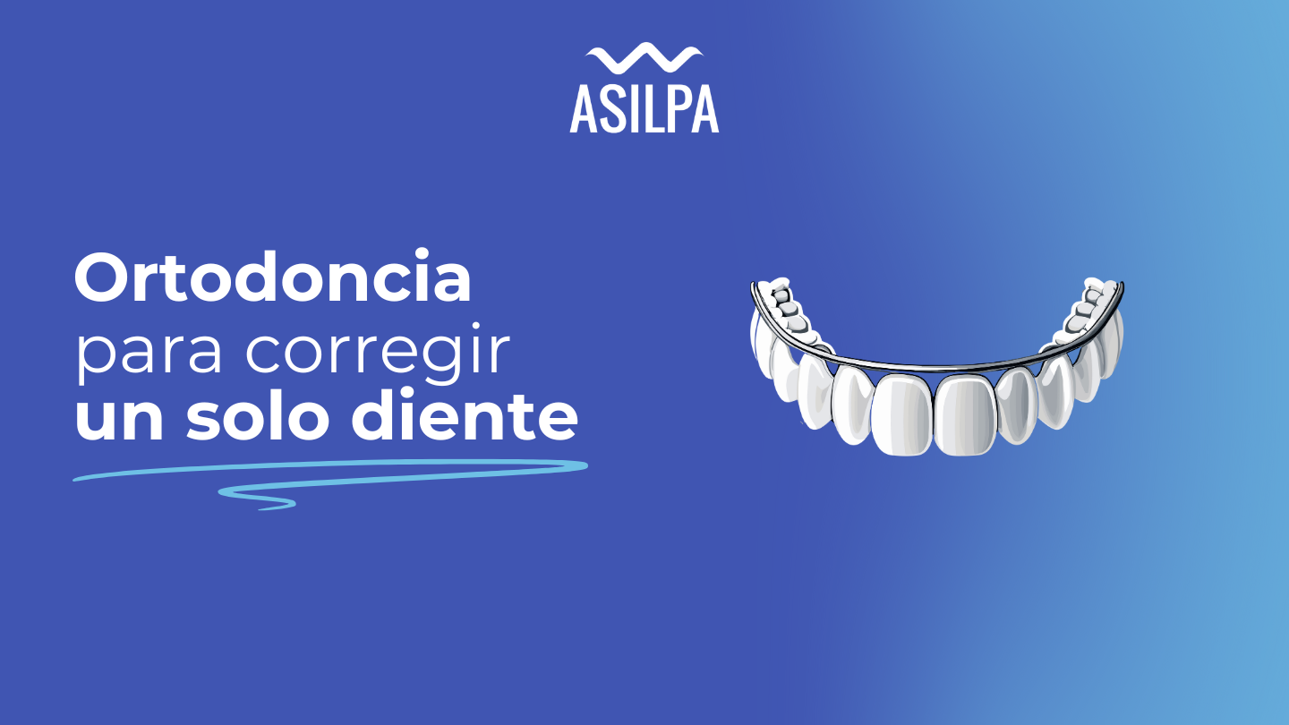 ortodoncia para corregir un solo diente