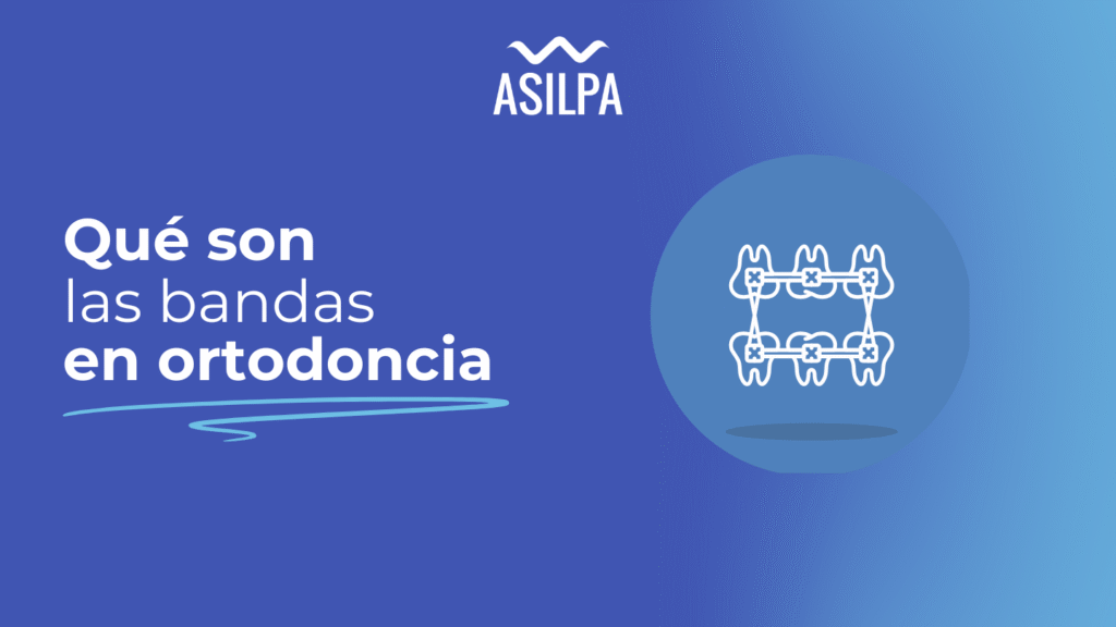 que son bandas en ortodoncia