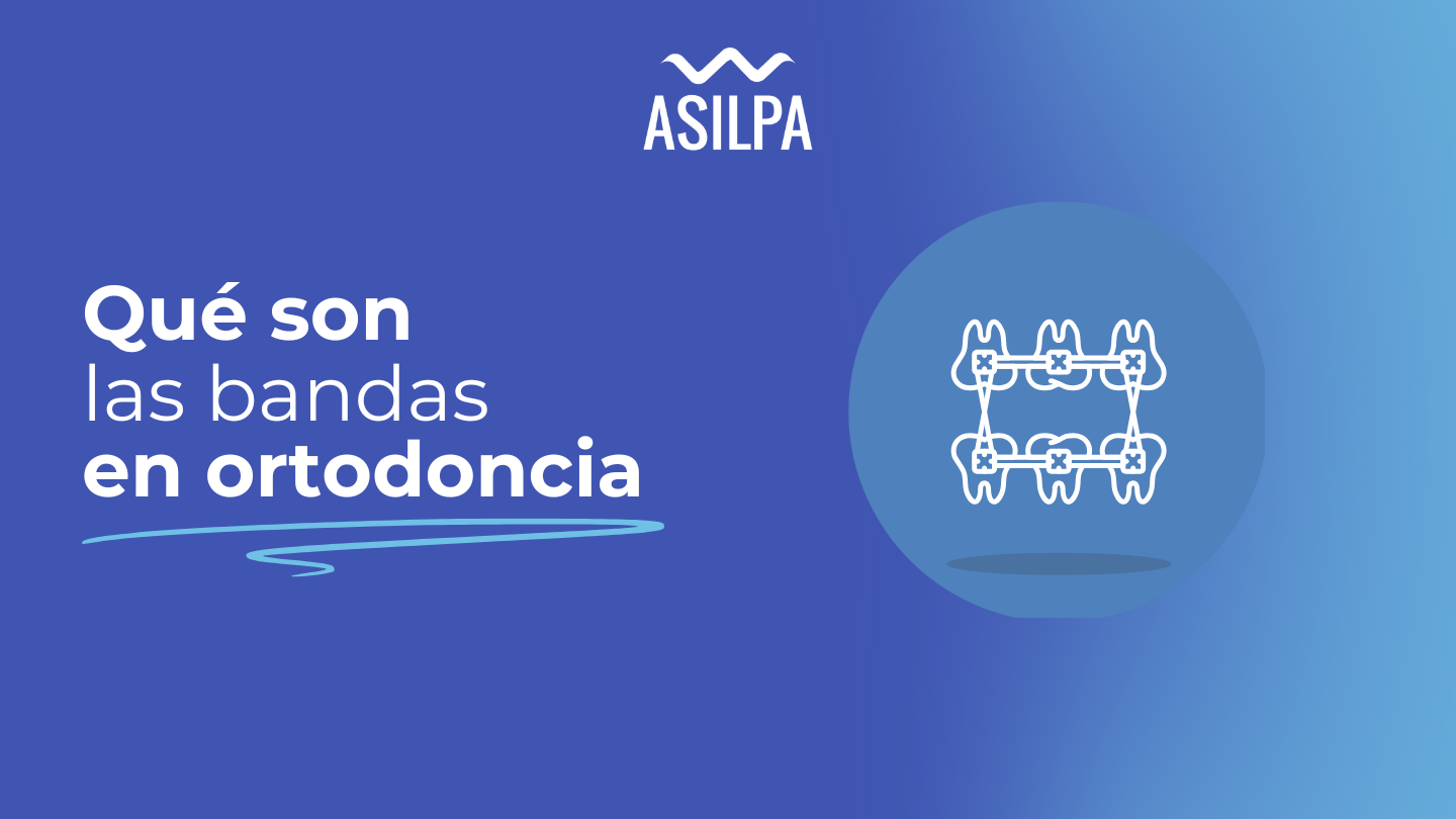 que son bandas en ortodoncia