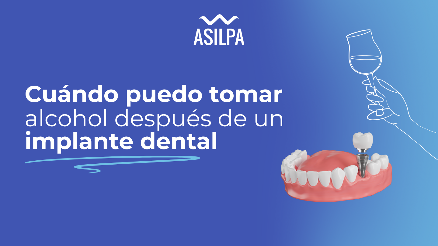 cuando puedo tomar alcohol despues de un implante dental