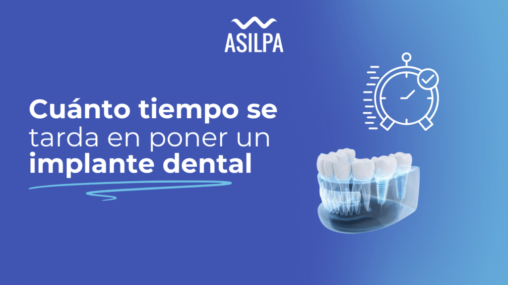 cuanto tiempo se tarda en poner un implante dental​