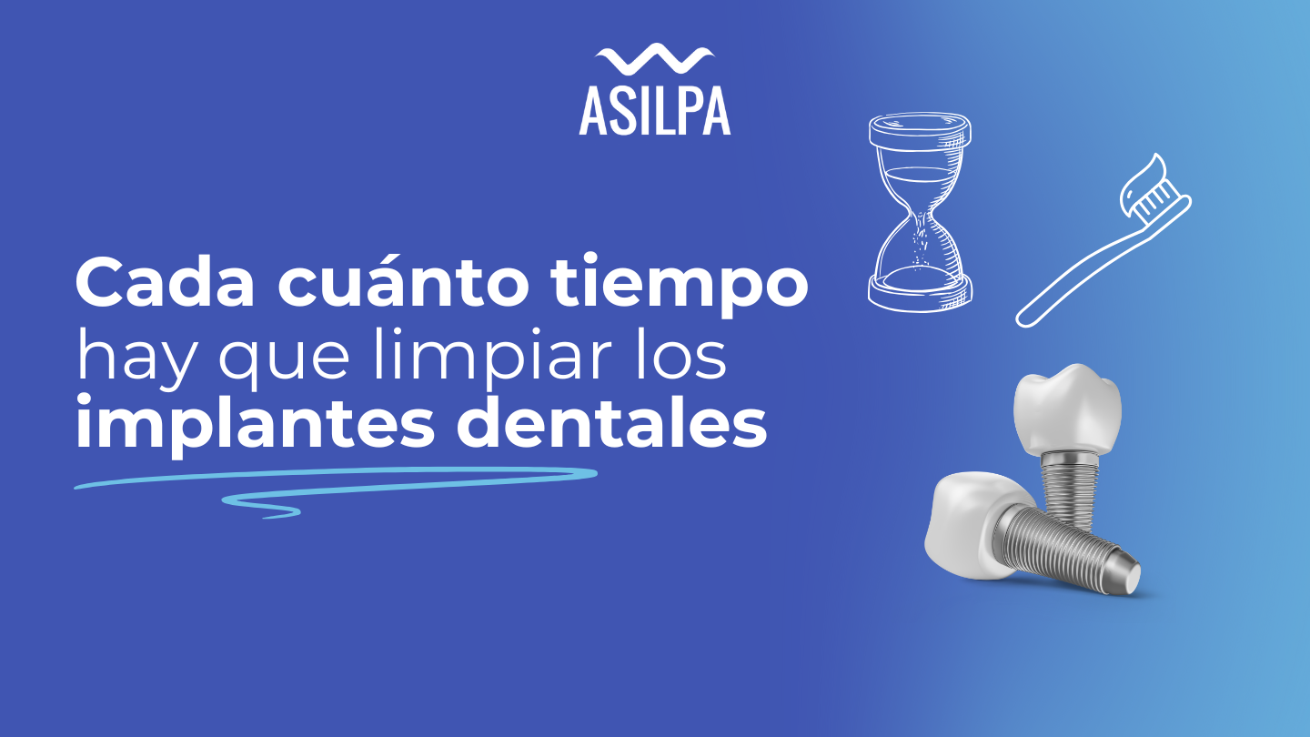 cada cuanto tiempo hay que limpiar los implantes dentales​