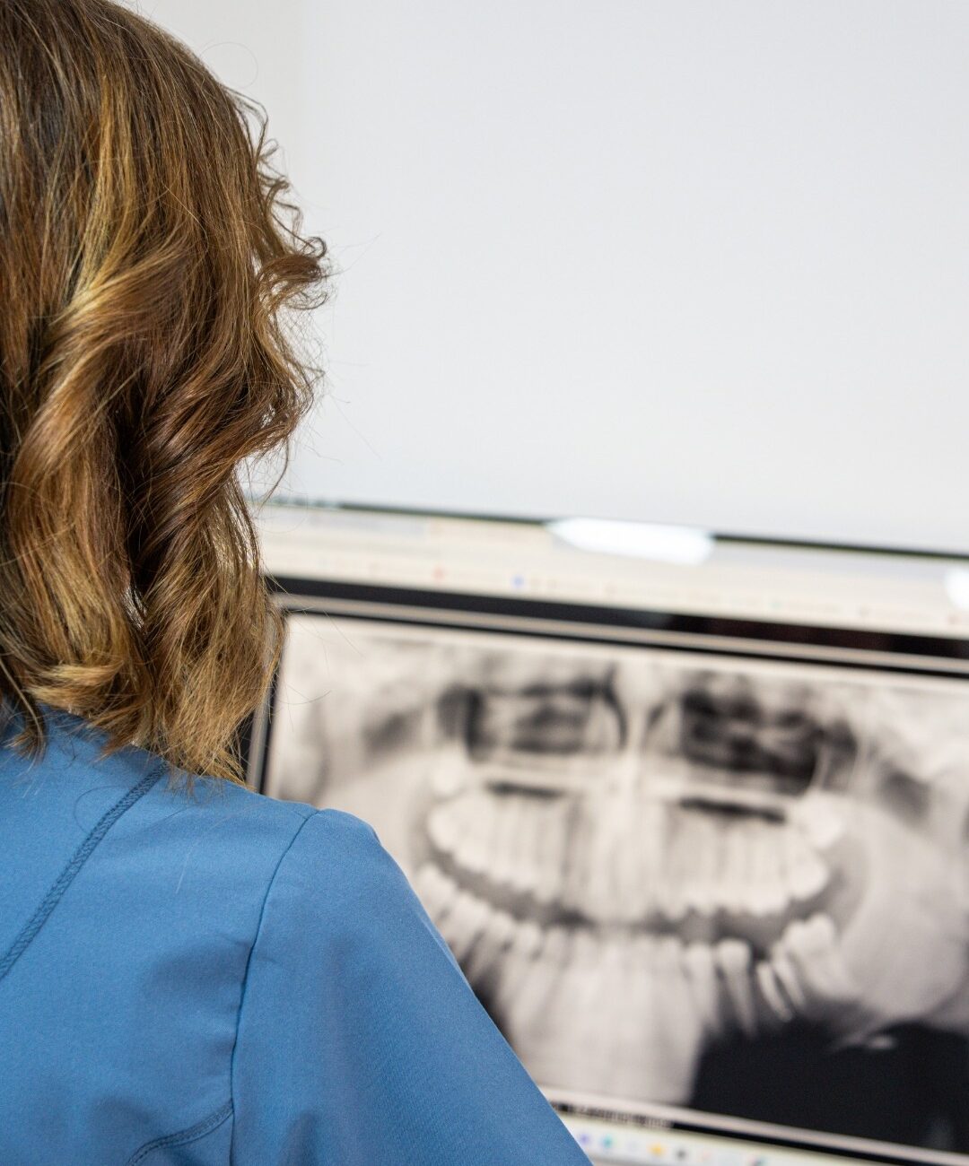 estetica dental en alicante