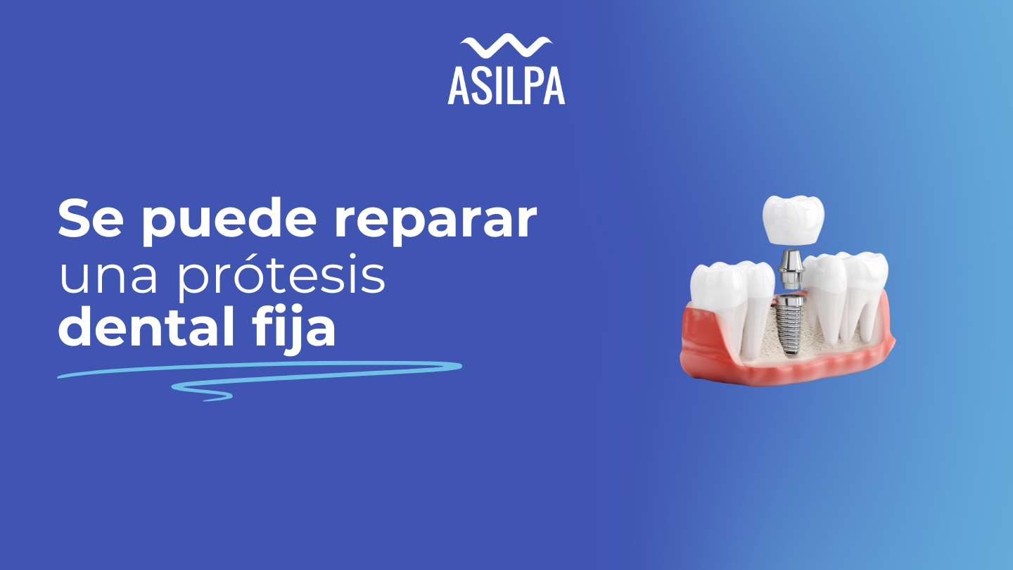 se puede reparar una protesis dental fija