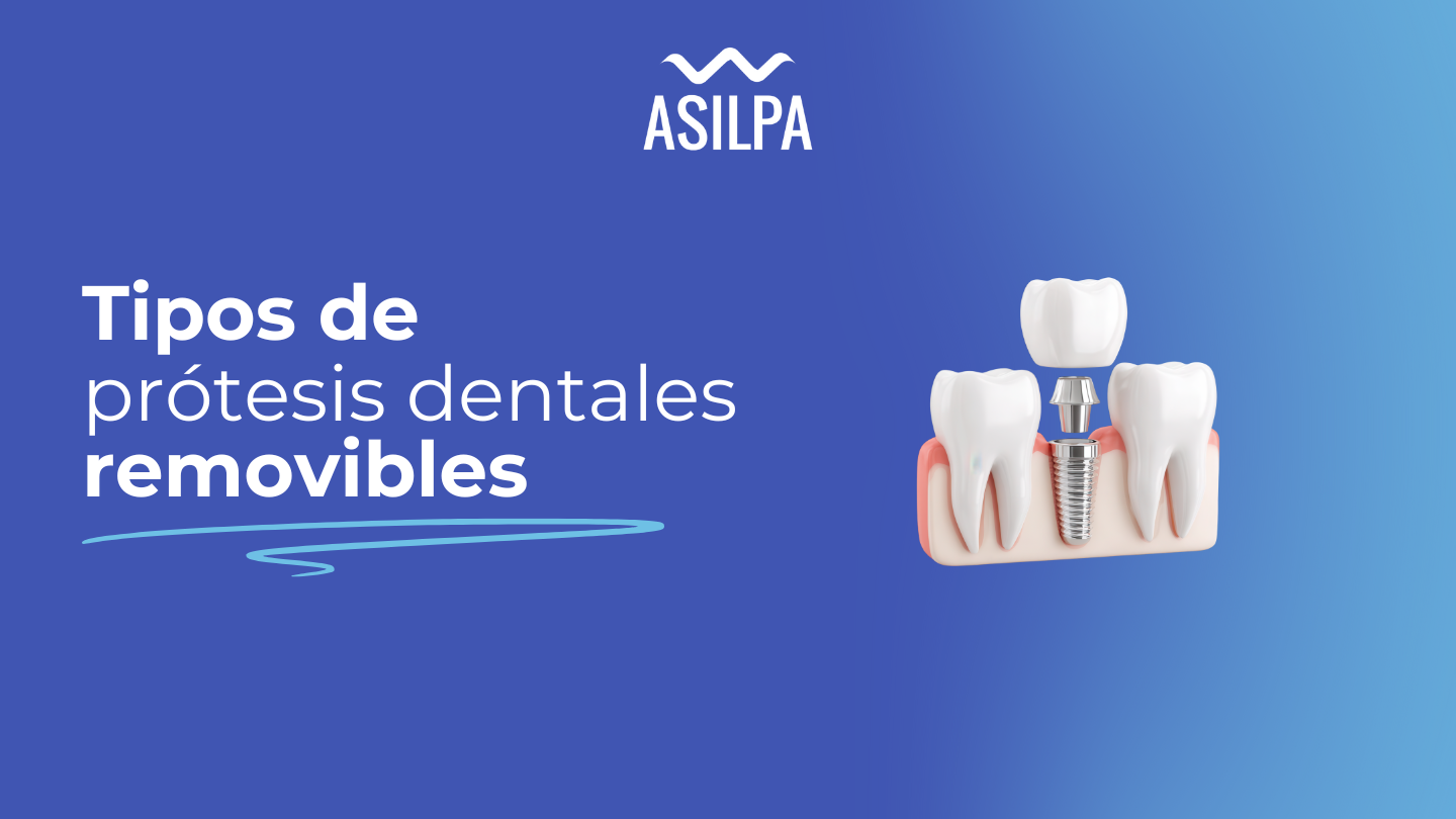 tipos de protesis dentales removibles​