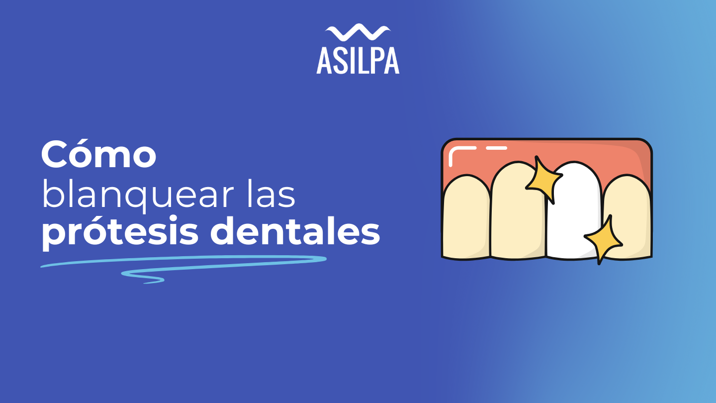 como blanquear las protesis dentales