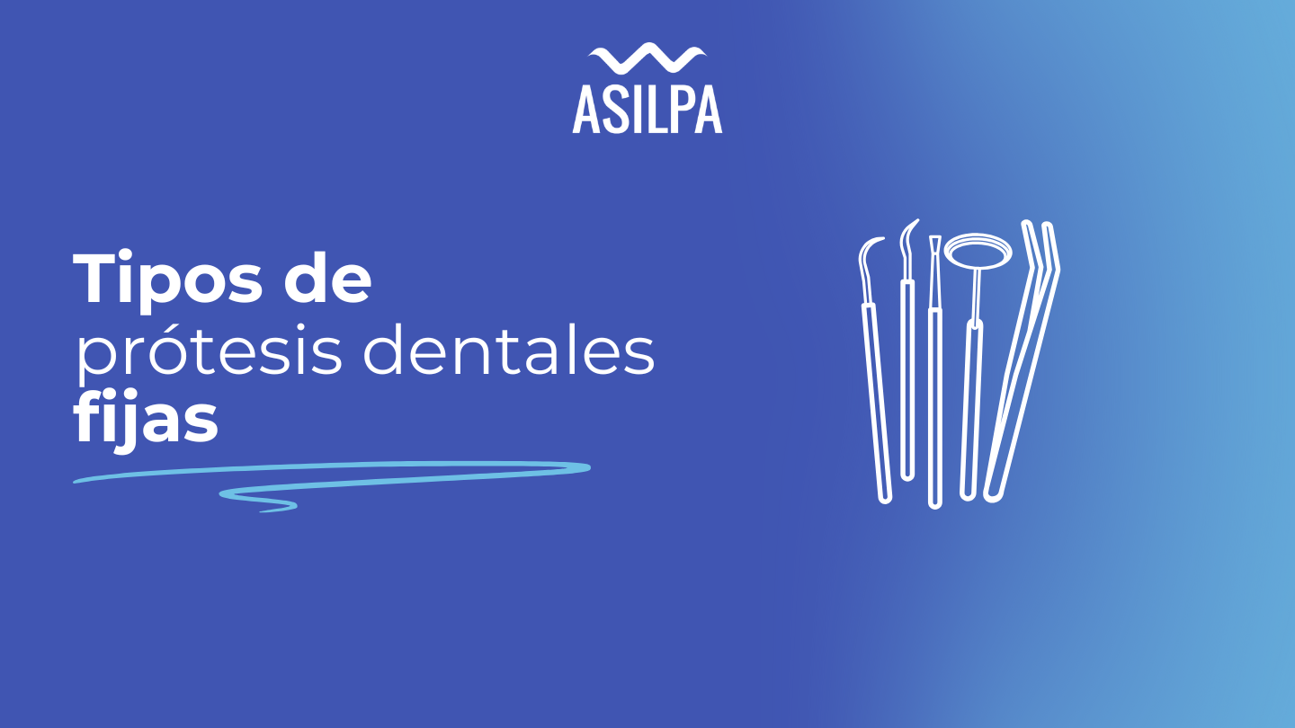 tipos de protesis dentales fijas​
