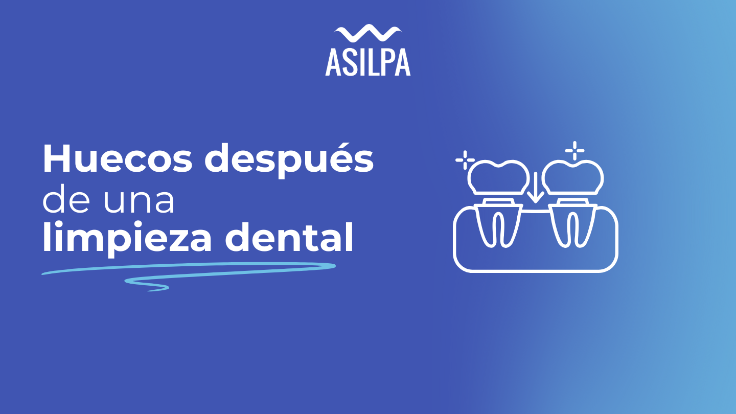 huecos después de limpieza dental​