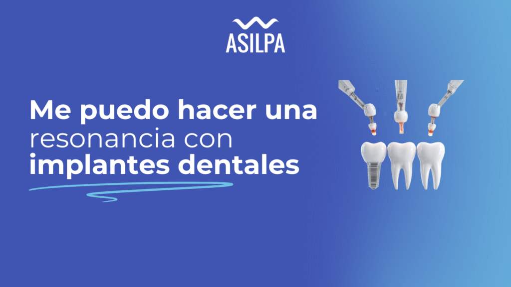 me puedo hacer una resonancia con implantes dentales