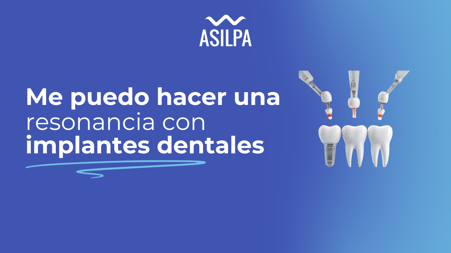 me puedo hacer una resonancia con implantes dentales