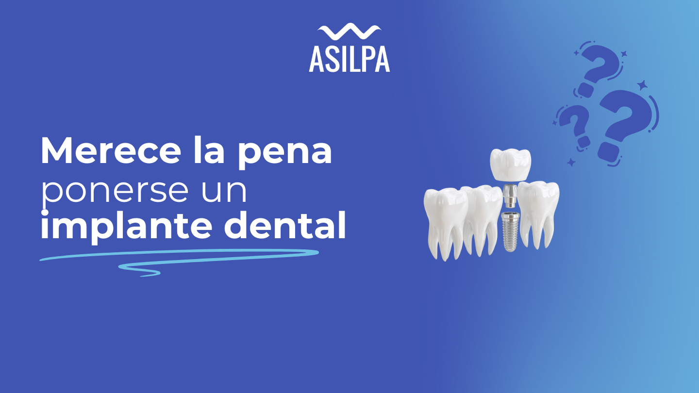 merece la pena ponerse un implante dental