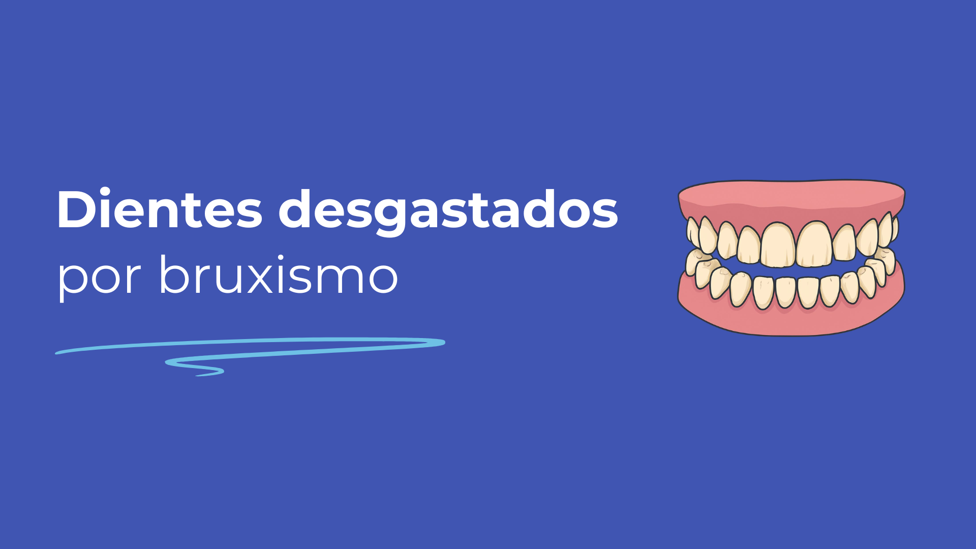 Dientes desgastados por bruxismo