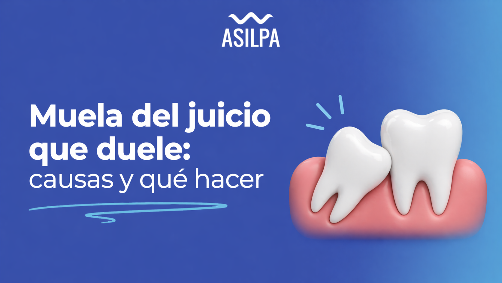 Muela del juicio y sus causas