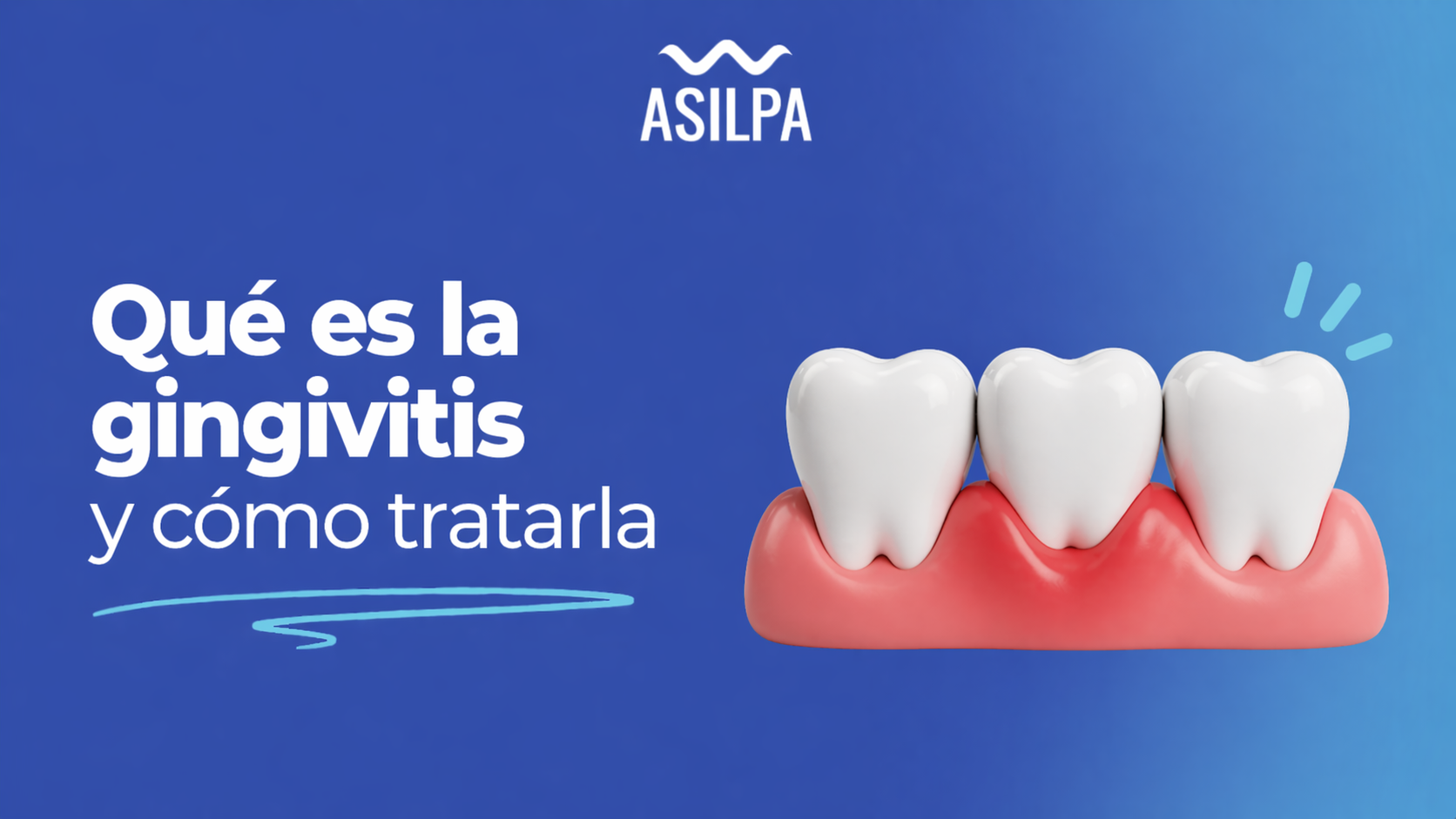 Qué es la gingivitis y cómo tratarla