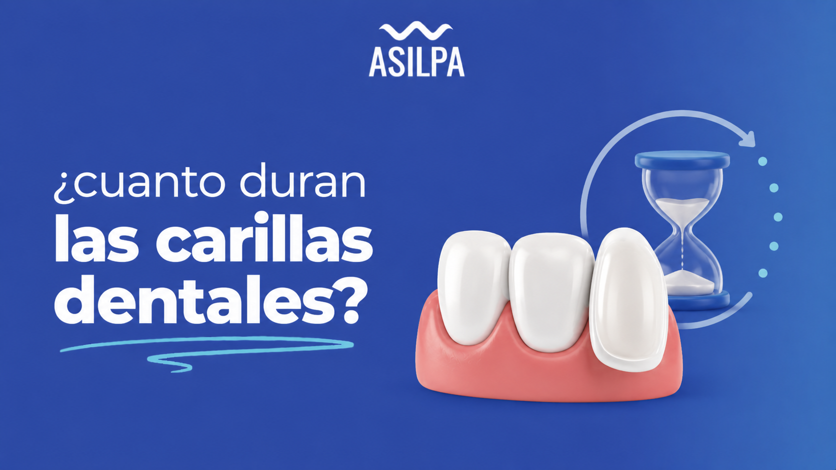 ¿Cuánto duran las carillas dentales?
