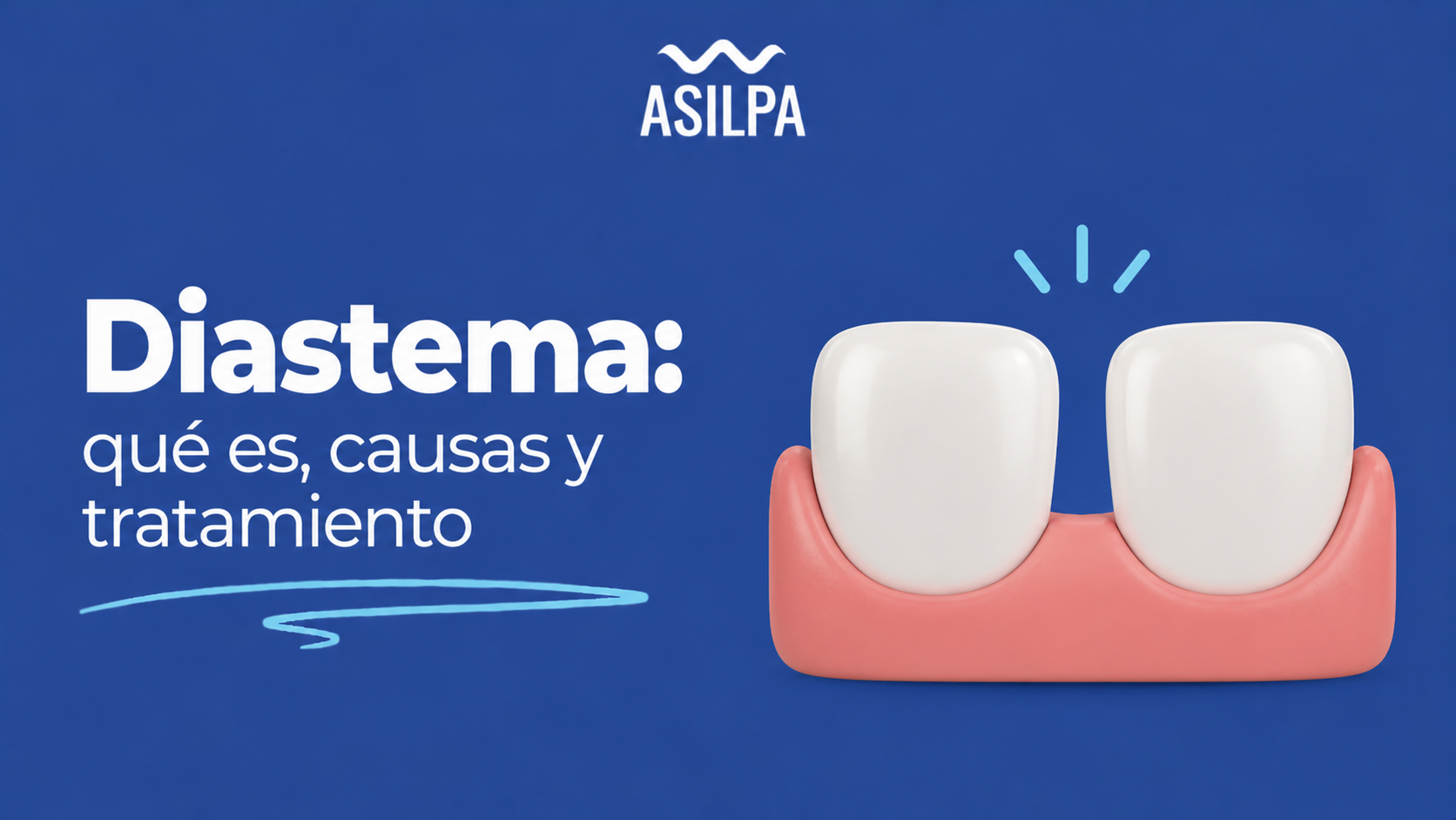Diastema: qué es, causas y tratamiento | Clínica Asilpa