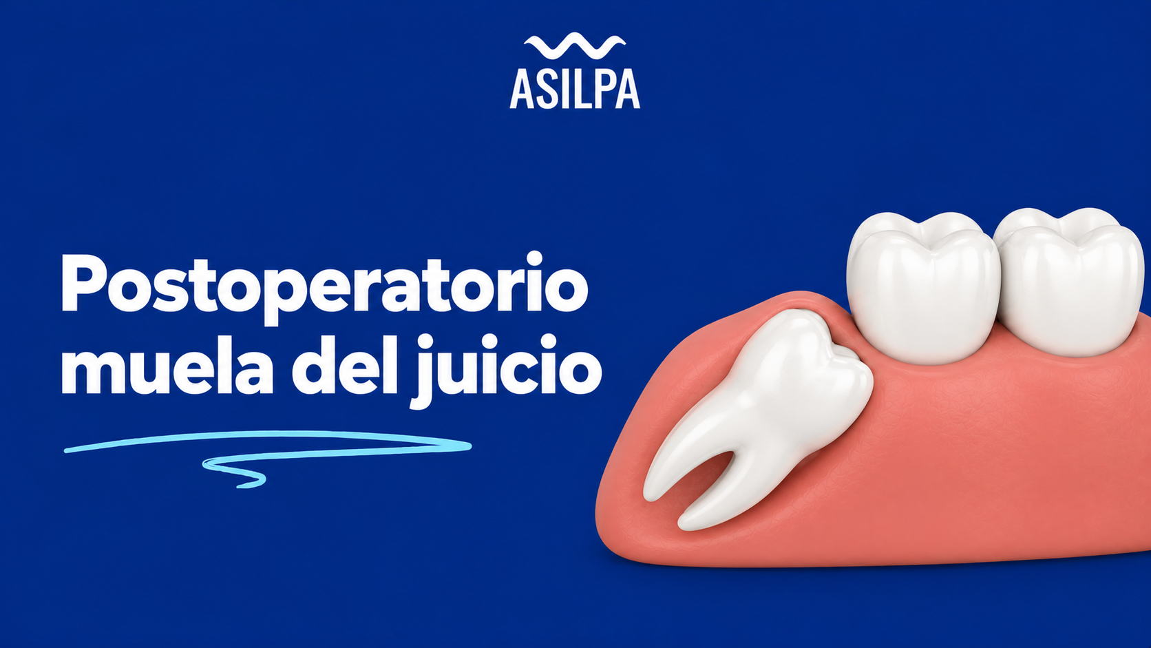 Postoperatorio extracción muela del juicio